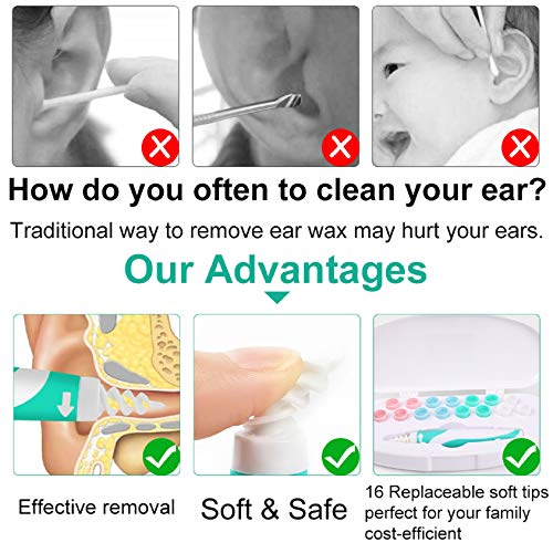 KDO Q-Grips Earwax Remover Silicone Ear-Wax-Removal-Tool Safe Soft Ear Cleane...