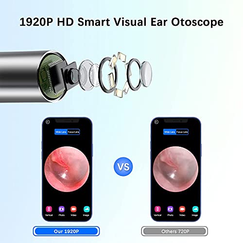 Ear Wax Removal Kit, Ear Wax Removal Endoscope, Earwax Remover Tool, 1920P HD...