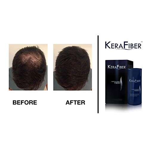 KeraFiber Hair Building Fibers, Dark Brown, 0.98 Ounce