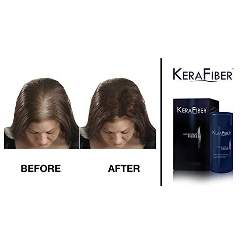KeraFiber Hair Building Fibers, Dark Brown, 0.98 Ounce