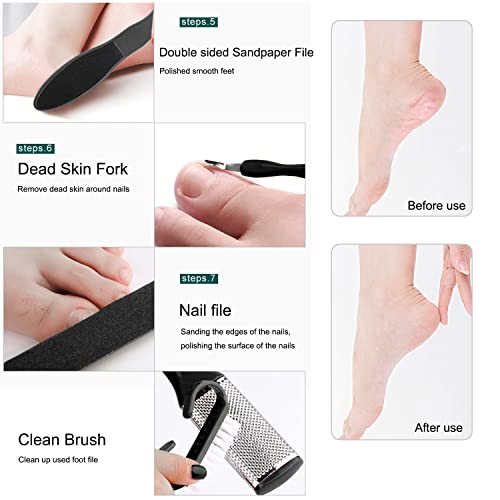 Professional Pedicure Tools Set, 10 in 1 Stainless Steel Foot Care Kit Foot R...