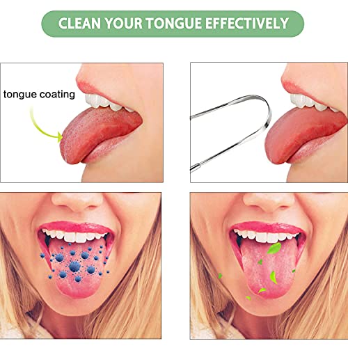 Keylitos Tongue Scraper (2 Pack), Tongue Cleaner Surgical Grade Stainless Ste...