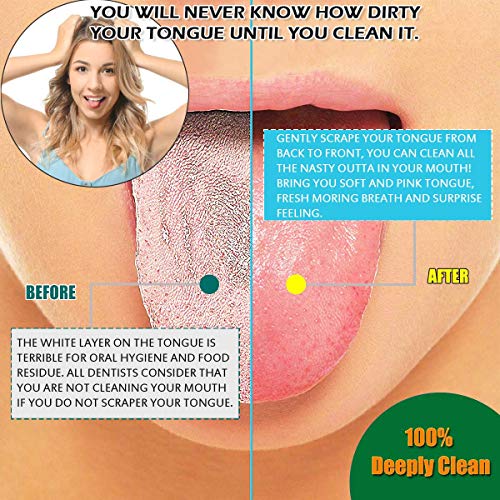 Keylitos Tongue Scraper (2 Pack), Tongue Cleaner Surgical Grade Stainless Ste...