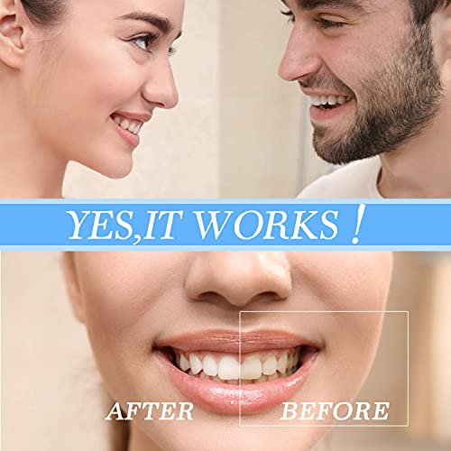 Keylitos Tongue Scraper (2 Pack), Tongue Cleaner Surgical Grade Stainless Ste...