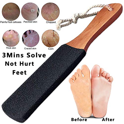 Kinepi Foot Scrubber Pedicure Foot File Pumice Stone,Professional Pedicure Su...