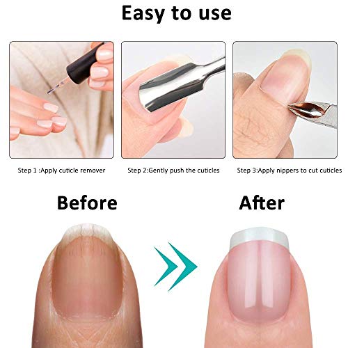 KK-mall Cuticle Trimmer Nippers with Cuticle Pusher & Nail Polish Remover & N...