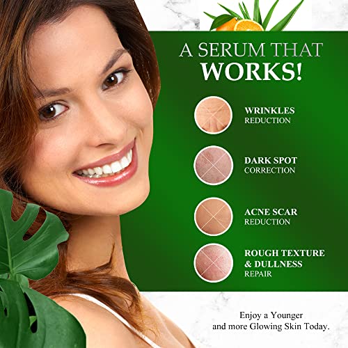 Kleem Organics Vitamin C Serum for Face with Hyaluronic Acid & Vitamin E | Na...