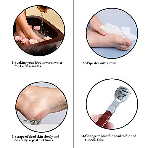Foot Care Pedicure Callus Shaver Hard Skin Remover,Foot Callus Remover,Callus...