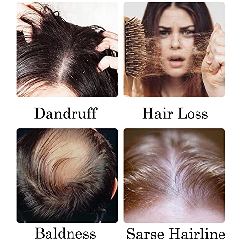 KOECPS Hair Comb, Electric Growth Hair Combs For All Hair Types, Treatment Vi...