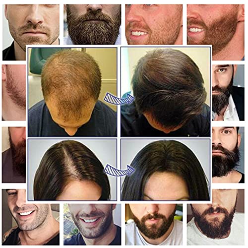 Koi Beauty Derma Roller Professional For Hair Beard Growth And Face with 192 ...