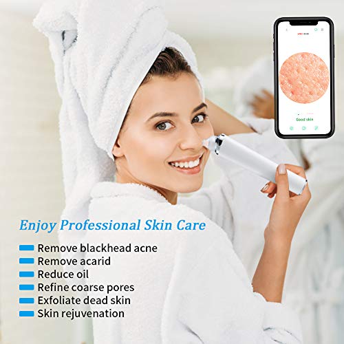 Visual Blackhead Remover Pore Vacuum - Koolertron 5.0 Megapixels HD Camera Wi...
