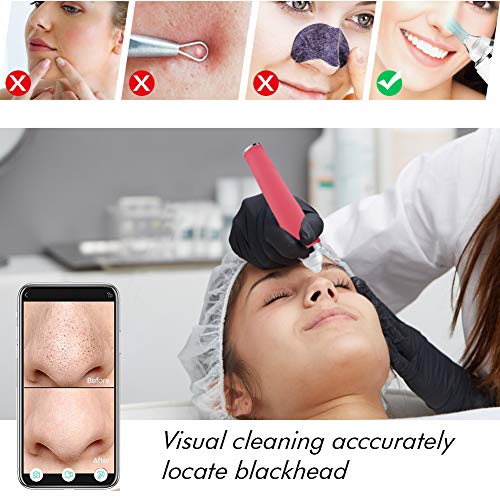 Visual Blackhead Remover Pore Vacuum - Koolertron 5.0 Megapixels HD Camera Wi...