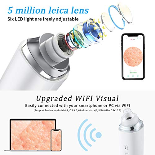 Visual Blackhead Remover Pore Vacuum - Koolertron 5.0 Megapixels HD Camera Wi...
