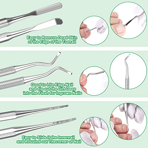 6-Pack Ingrown Toenail File And Lifters, Professional Surgical Stainless Stee...