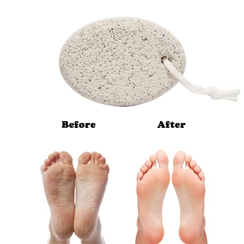 Pumice Stone for Feet 4 pcs, KUTOLAKI Natural Lava Pumice Stone, Pumice Scrub...
