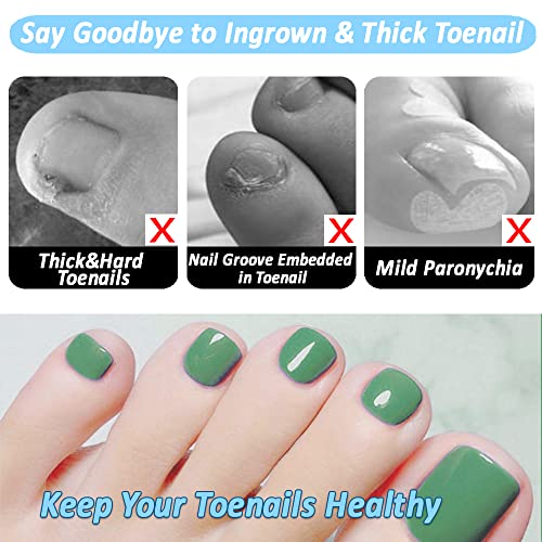 Podiatrist Toenail Clippers for Thick Nails, Professional Ingrown Toenail Too...