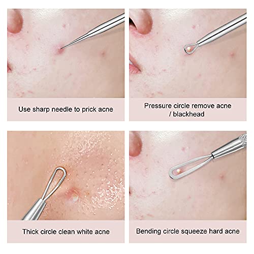 Blackhead Remover, 2 PCS Pimple Popper Tool，Stainless Steel Pimple Extractor...
