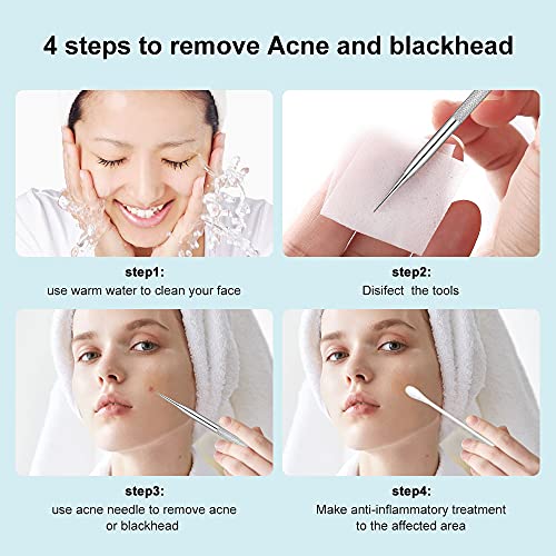 Blackhead Remover, 2 PCS Pimple Popper Tool，Stainless Steel Pimple Extractor...