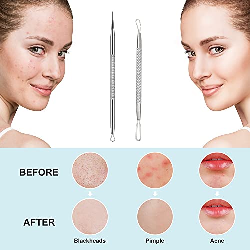 Blackhead Remover, 2 PCS Pimple Popper Tool，Stainless Steel Pimple Extractor...