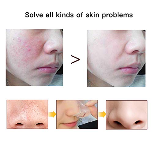 12pairs=24pcs Press on False Nails+Blackhead Remover Peel Off Mask