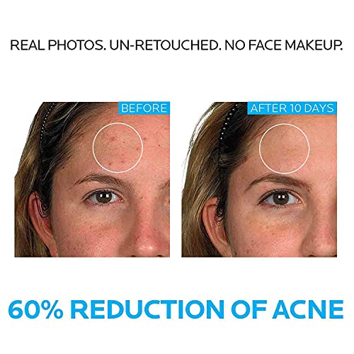 La Roche-Posay Effaclar Dermatological Acne Treatment 3-Step System with Medi...