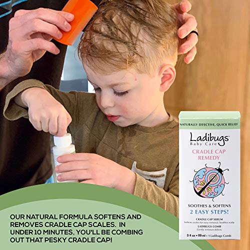 Ladibugs Cradle Cap Remedy Kit, 3oz | Includes Cradle Cap Serum & Fine-Toothe...