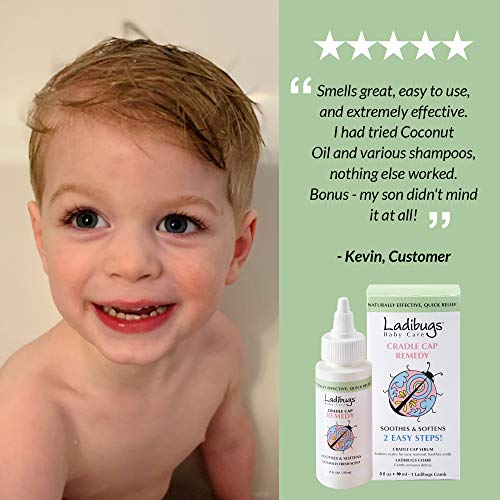 Ladibugs Cradle Cap Remedy Kit, 3oz | Includes Cradle Cap Serum & Fine-Toothe...