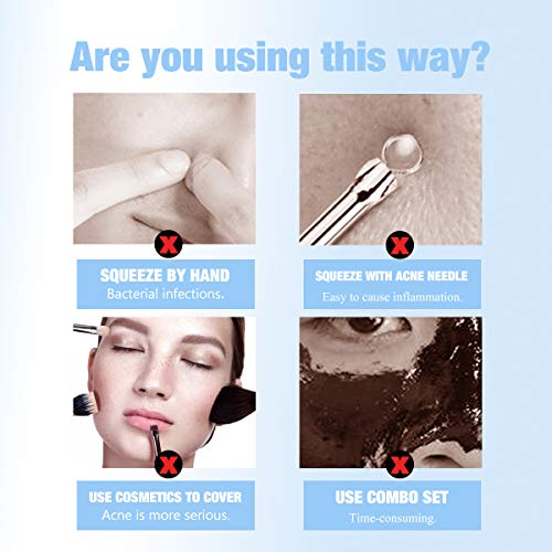 LAMUSELAND Deep Cleansing Pore Strips, 30 Pcs Nose Strip Set for Blackhead Re...