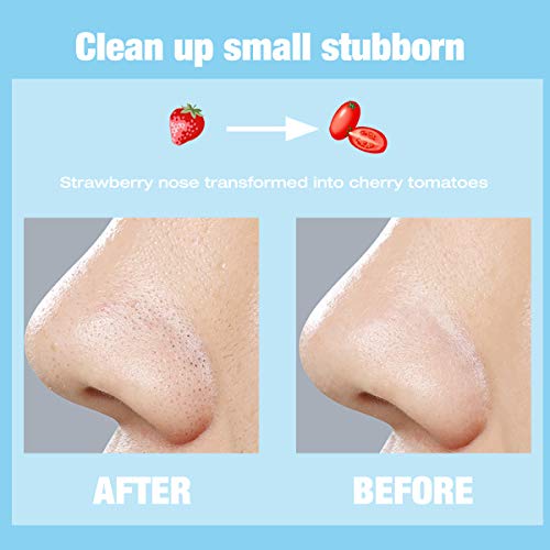 LAMUSELAND Deep Cleansing Pore Strips, 30 Pcs Nose Strip Set for Blackhead Re...