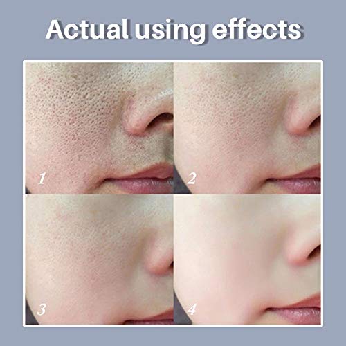 LANBENA Pore Skin Care Serum Facial Essence for Shrinking Pores + Relieving D...