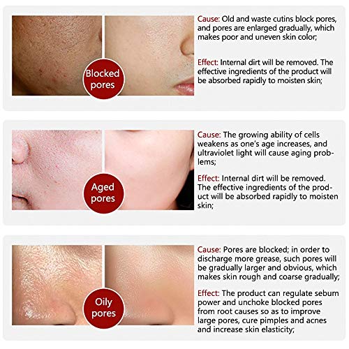 LANBENA Pore Skin Care Serum Facial Essence for Shrinking Pores + Relieving D...