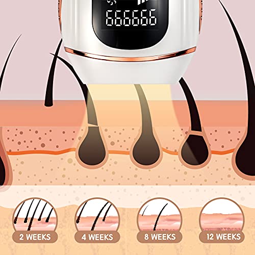 IPL Hair Removal Device,990,000 Flashes Laser Hair Removal Device for Women a...