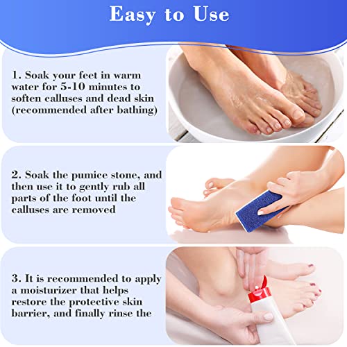 Pumice Stone for Feet Foot Scrubber - Larbois 4Pack Pumice Stone for Feet Cal...