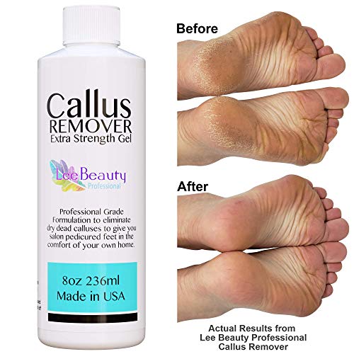 Lee Beauty Professional Callus Remover Extra Strength Gel for Feet, At Home P...