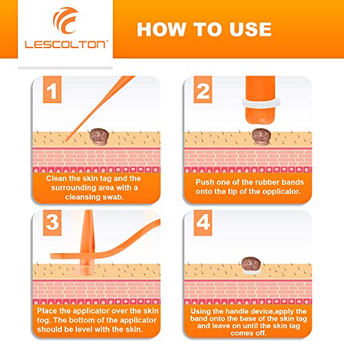 Lescolton Skin Tag Removal Kit 2-7mm Skin Tag Remover Device 40 Bands Skin Ta...