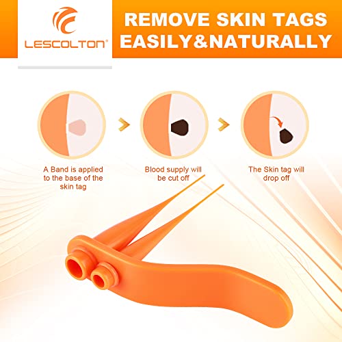 Lescolton Skin Tag Removal Kit 2-7mm Skin Tag Remover Device 40 Bands Skin Ta...