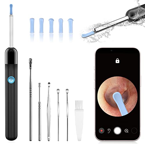 Ear Wax Removal, 1296P FHD Wireless Wifi Ear Wax Removal Tool with Camera, 6 ...