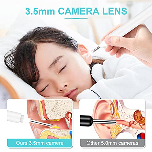 Ear Wax Removal Tool with Ear Wax Removal Camera, LHAIM Ear Cleaner, 1920P FH...