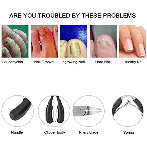 LIAODEHENA Cuticle Trimmer Manicure,Tools Ingrown Toe Nail Clippers Fingernai...