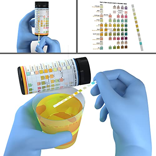 Complete 10-in-1 Urine Test Strips 100ct | Urinalysis Dip-Stick Testing Kit |...