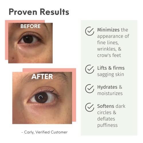 LilyAna Naturals Eye Cream - 2-Month Supply - Made in USA, Eye Cream for Dark...