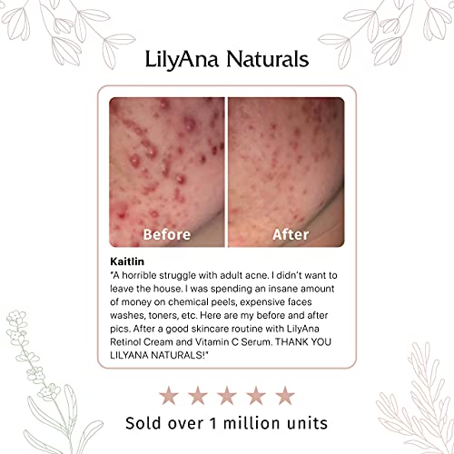 LilyAna Naturals Vitamin C Serum for Face - Made in USA, Face Serum with Hyal...