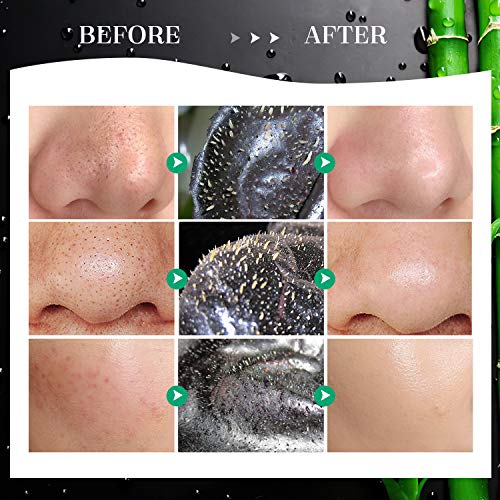 Blackhead Remover Mask Blackhead Peel Facial Mask Charcoal Facial Mask,With H...