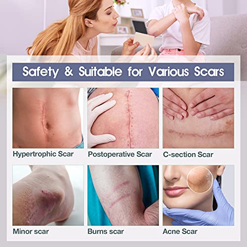 Medical Grade Soft Silicone Tape 1'' x 70'', 35 Sheets Easy to Tear Soft Sili...