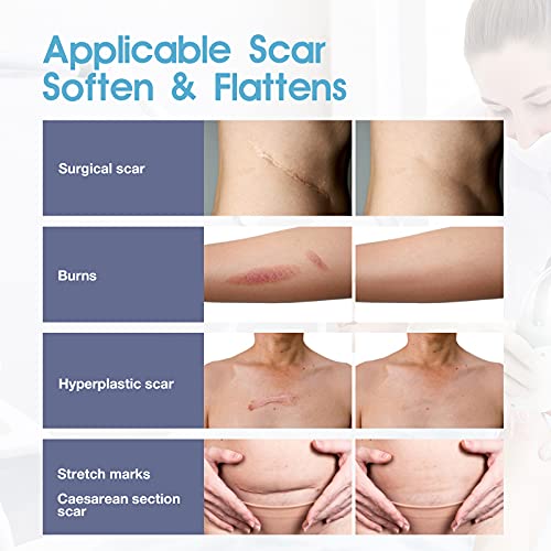 Medical Grade Soft Silicone Tape 1'' x 70'', 35 Sheets Easy to Tear Soft Sili...