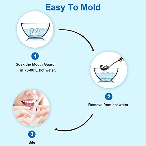 Kids Mouth Guard for Teeth Grinding, Pack of 4 Bite Guards + Dental Guard Cas...