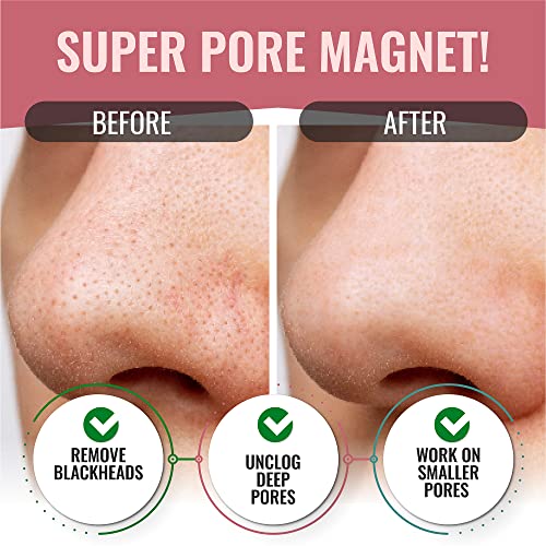 Look At Me Nose Pore Strips (2-Pack, 10 Nose Strips). Korean Skin Care Blackh...