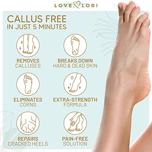 Foot Callus Remover Gel 6oz By Love, Lori - Callus Remover For Feet & Dead Sk...