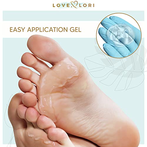 Foot Callus Remover Gel 6oz By Love, Lori - Callus Remover For Feet & Dead Sk...