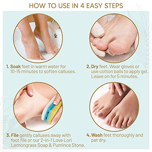 Foot Callus Remover Gel 6oz By Love, Lori - Callus Remover For Feet & Dead Sk...